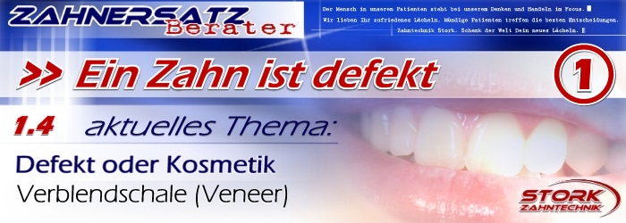 Ein Zahn ist defekt